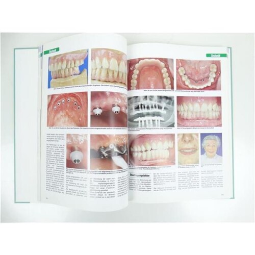 dental labor-Fachbuchreihe Implantatprothetik