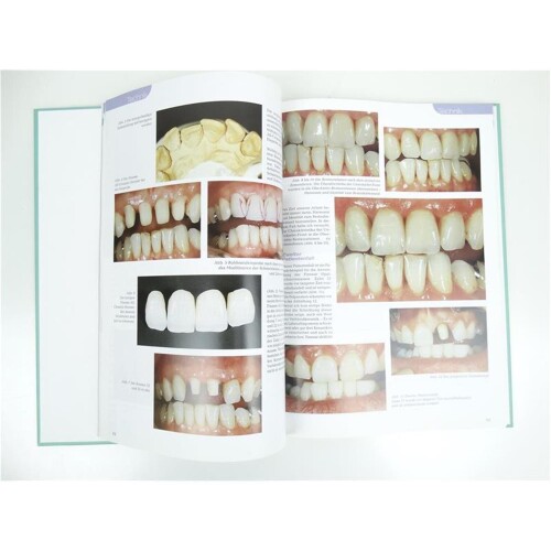 dental labor-Fachbuchreihe Vollkeramik